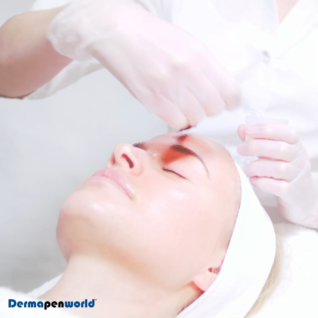 Dermapen 4 MG Collection